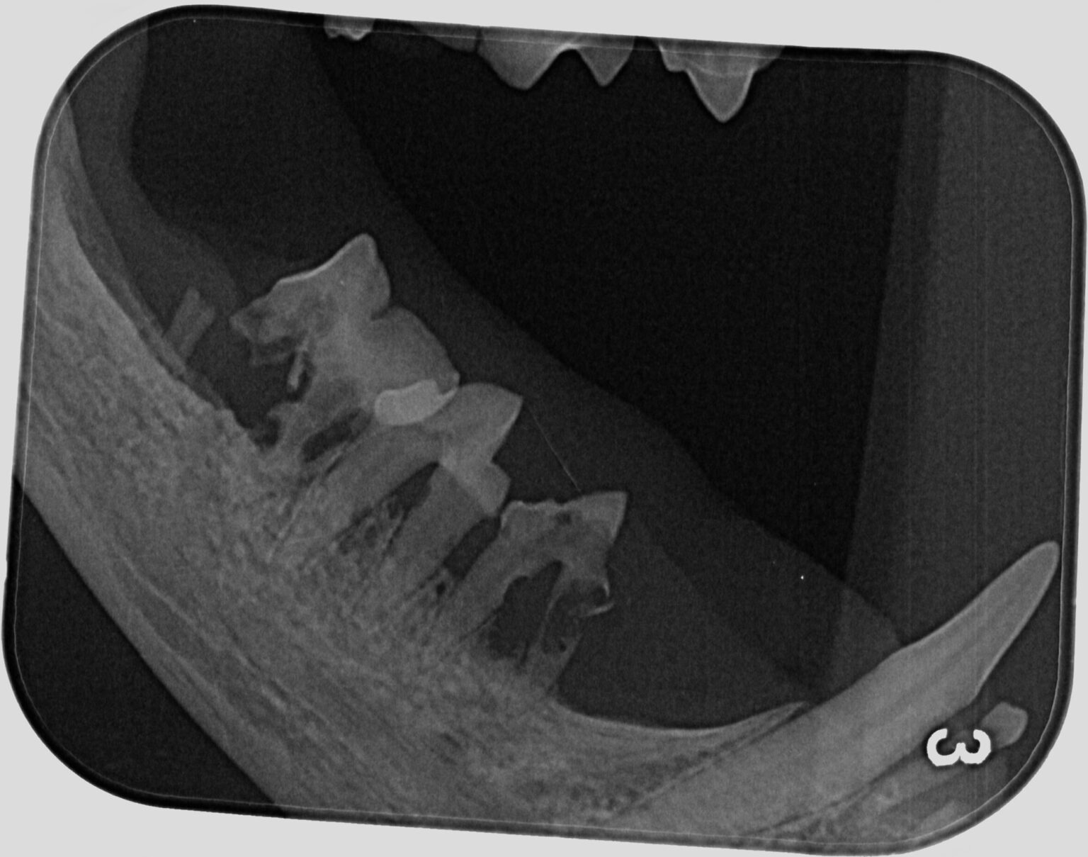 MT: FORL und CORL: Diagnose und Behandlungsmethoden